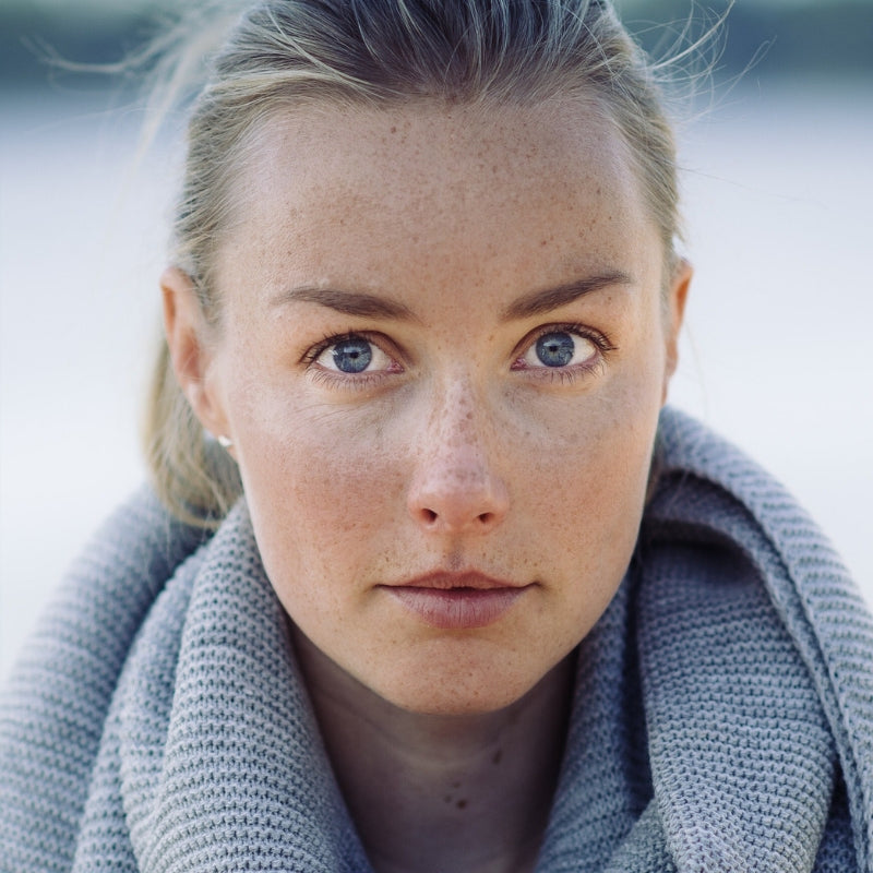 Unohda sitruunamehu - 6 vinkkiä maksaläiskien hoitoon!